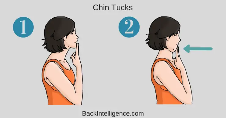 forward head posture neck hump