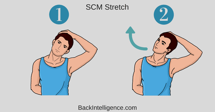 SCM Stretch