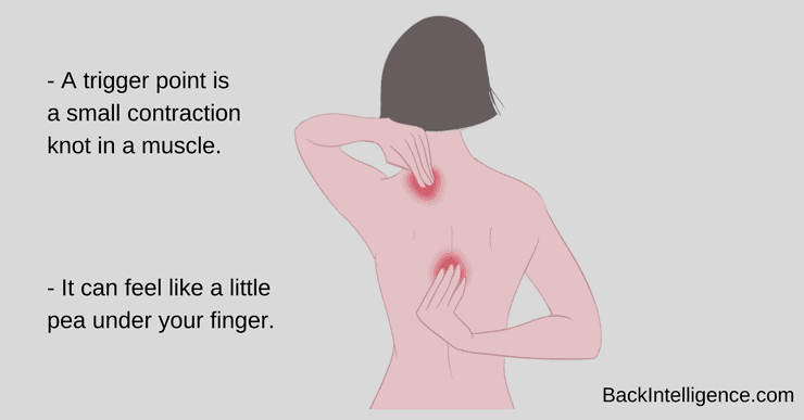 Upper Back, Shoulder, and Arm  The Trigger Point & Referred Pain