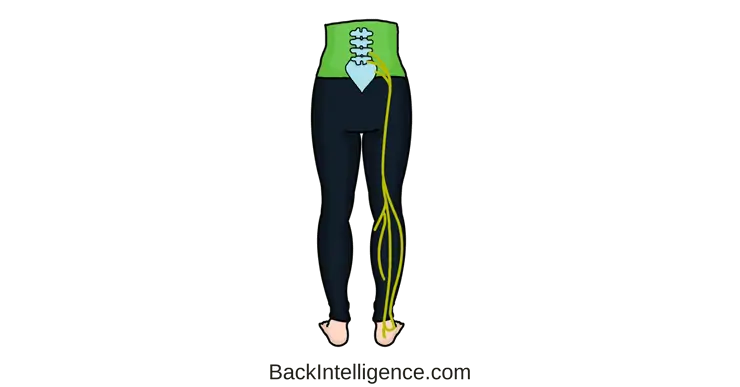 18 Stretches for Sciatica Pain Relief You Can Do at Home – Chirp™