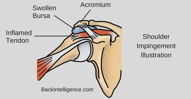 9 Easy Physical Therapy Exercises for Shoulder Impingement