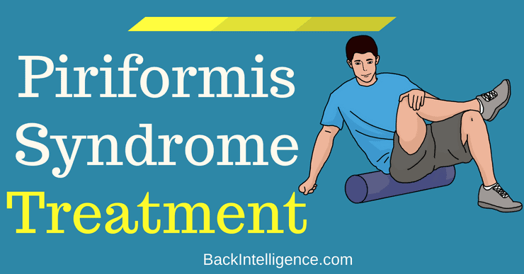 Easy Piriformis Syndrome Treatment and Exercises