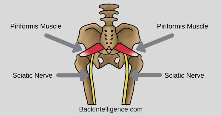 Piriformis Syndrome Treatment At Home Symptoms Causes Stretches 2022