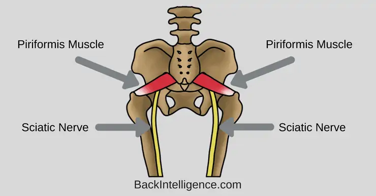 leg Pain, Could it be Piriformis Syndrome ? Relief at Health Wise