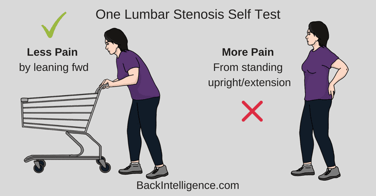 Lumbar Spinal Stenosis Causes and Diagnosis