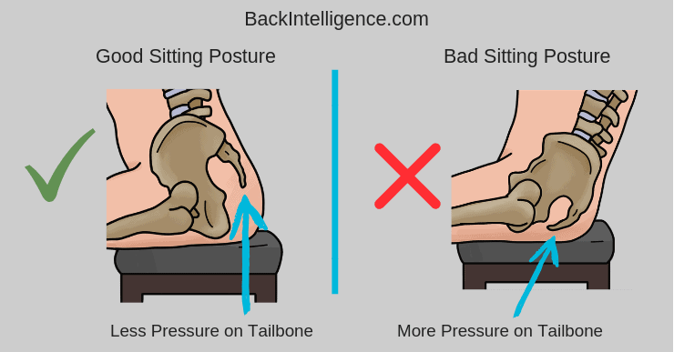 Tailbone Pain When Sitting Coccydynia Diy Relief Exercises