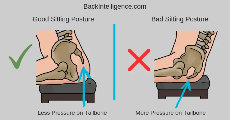 Tailbone Pain When Sitting (Coccydynia) - DIY Relief & Exercises