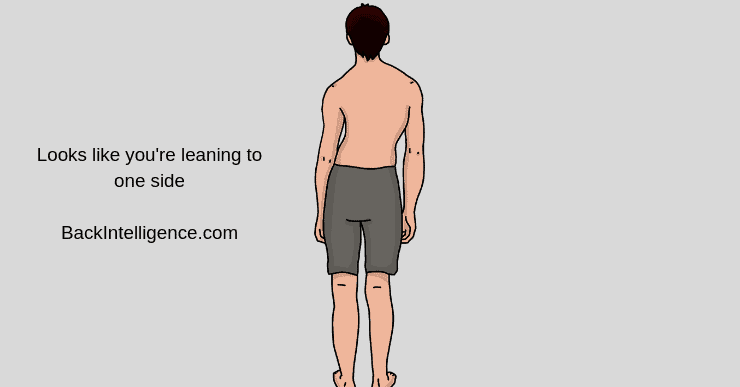 scoliosis-treatment-4-methods-back-intelligence